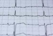 global pulse revenue impact