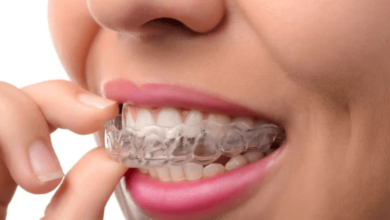 The Smart Way To Align Your Teeth Without Braces